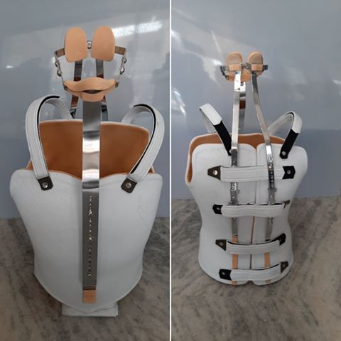 mycaremedical's tweet photo. Custom Milwaukee Brace with extended pelvic girdle #milwaukeebrace #ctlso #scoliosis #kyphosis #spinal_brace #recreational_braces #recreational #fetish #mycaremedical #orthotics #brace_makers #nearme https://t.co/cTcoM88Ioq