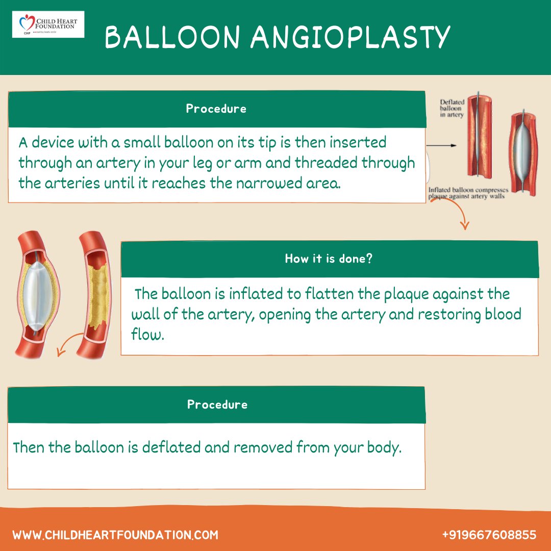 ChildHeartFndn's tweet photo. Medically known as percutaneous coronary intervention, angioplasty is a minimally invasive surgical procedure that is performed to remove the blockage formed by plaques in the coronary arteries. #angioplasty #chd #awareness #chdaware #heartdisease #hope #donate #csr #ngo https://t.co/qpM2WhdzrR
