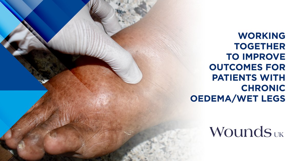 Wounds_UK's tweet photo. Chronic #oedema is a condition that worsens with excess fluid leaking onto the skin, resulting in 'wet legs'. Prevention, early intervention &amp; the provision of appropriate compression are key to optimising patient outcomes. Read more: https://t.co/mIaYiPDrYQ #WUK https://t.co/oGirsYFjad