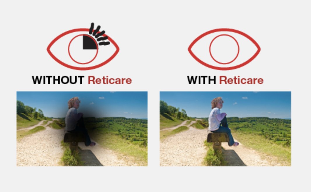 reticare_usa's tweet photo. ⚡️❗️Have you noticed how device screens illuminate children's faces? 

🚨Are you aware of the consequences?
  
Contact us:
📲(+1) 813 287 4867
✉️reticare@reticare.com
 https://t.co/hITcKsCnmo   

#BestBlueLightProtection https://t.co/bEVPjFEsKi