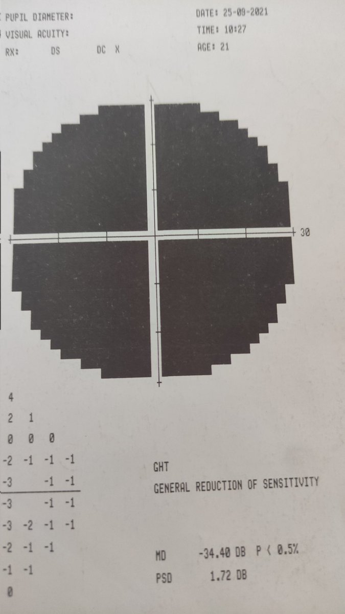 Yapılan görme alanı testim