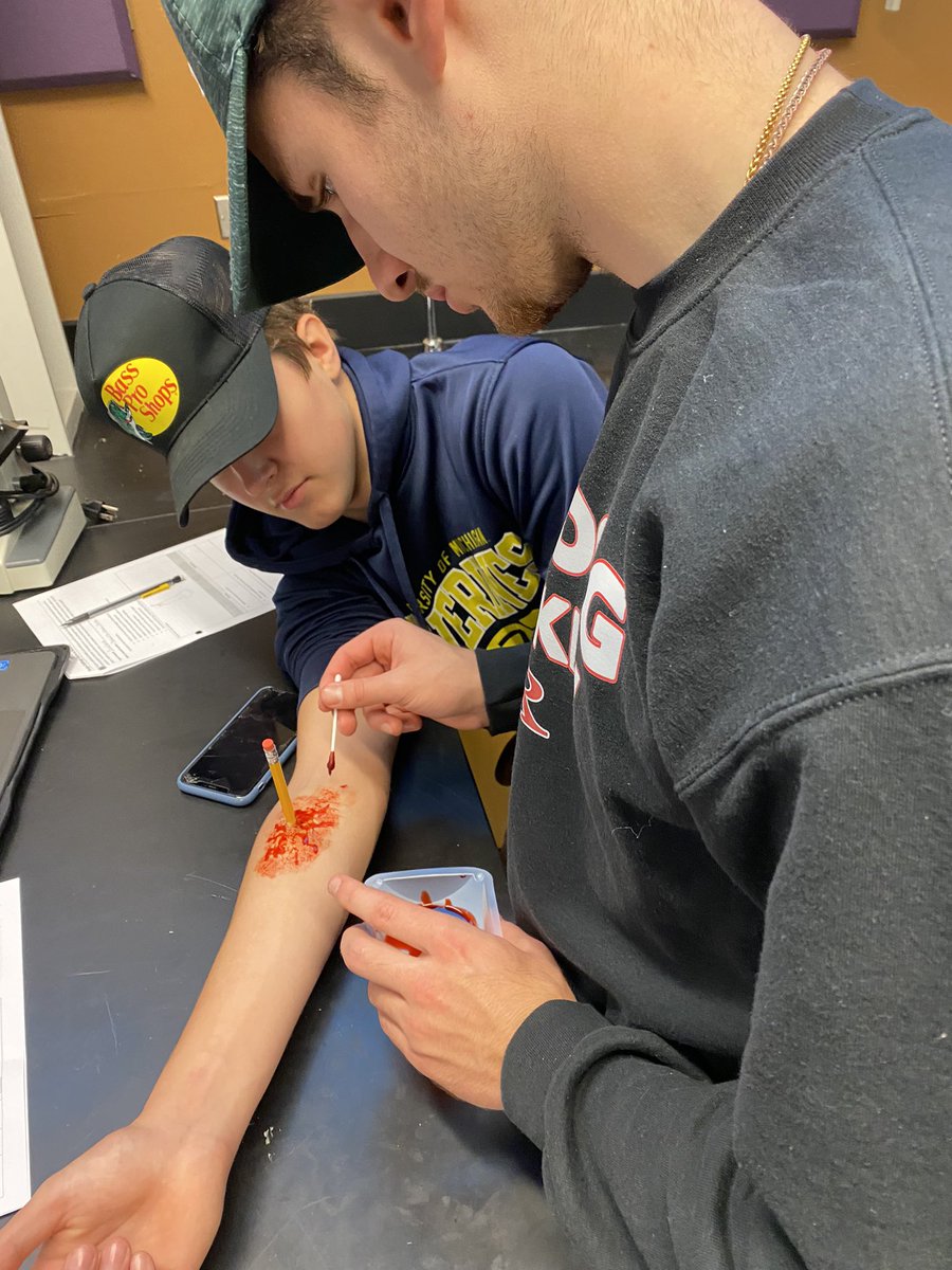 RienasScience's tweet photo. Burns and Wounds Lab #halloween #integumentarysystem #Rscience https://t.co/ARujjhRtC4