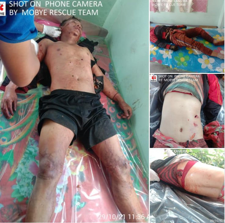 Tw // sensitive content ; In Moebye tsp, a local resident died and at least 1 other got injured from shrapnels owing to arbitrary shelling of military terrorists from battalion 422 today, reportedly. #WhatsHappeningInMyanmar #Oct29Coup #WarCrimesOfJunta