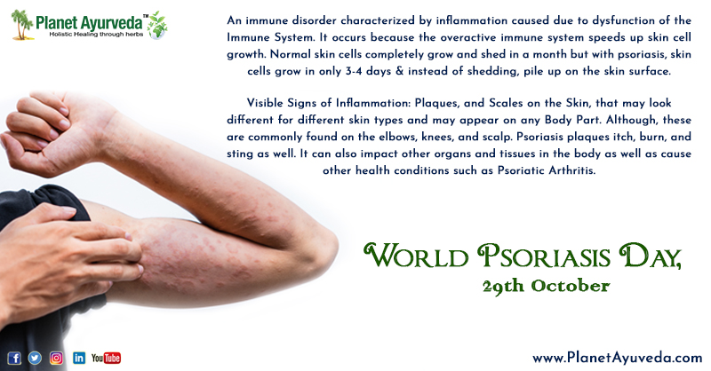 PlanetAyurveda4's tweet photo. World Psoriasis Day - 29th October
#worldpsoriasisday #worldpsoriasisday2021 #psoriasis #psoriasisdiet #psoriasisawareness #psoriasistreatment #psoriasiscommunity #psoriasisproblems #psoriasisrelief #psoriasislife #ayurvedasolution #psoriasiswarrior #specialday #herbalremedies https://t.co/RK8eX0ss31