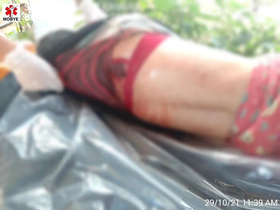 Merries1998's tweet photo. Happened at MoeByal, Kayah stateon Oct 29; a rocket which has been randomly fired by SAC killed at least 2 ppl who were working at farm n also injured some of the locals.

#Oct29Coup 
#WhatsHappeningInMyanmar https://t.co/vQEvylbJw6