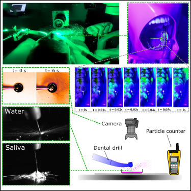 Our new paper on aerosols generated by dental procedures is out - I developed a new conceptual framework to understand the complexity of the fluid mechanical processes. cell.com/iscience/fullt…