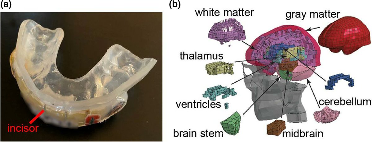 ABMEjournal's tweet photo. More from our Concussions in Sports Special Issue - "Time Window of Head Impact Kinematics Measurement for Calculation of Brain Strain and Strain Rate in American Football" @StanfordEng @SCCR_Stanford @StanfordRad @BMESociety @SpringerNature 

Link: https://t.co/pKL0KbXU08 https://t.co/2ojoE3TMsV