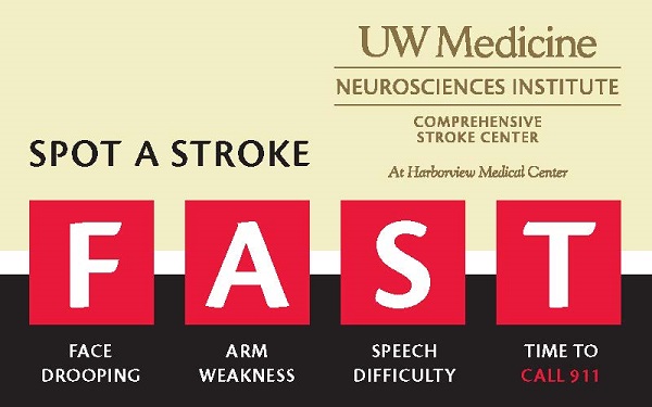 #Stroke is a leading cause of morbidity & mortality. Timely diagnosis can save lives. Don't miss out the signs of stroke:
🧠Face drooping
🧠Arm weakness
🧠Speech difficulty 
🧠Time for emergency medical help
#strokeawareness #NoLVOLeftBehind #WorldStrokeDay