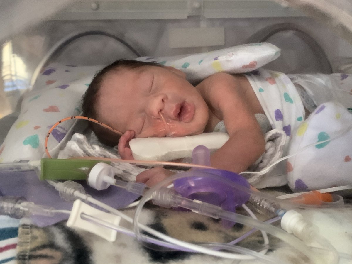 __Yaannaa__'s tweet photo. Then &amp; Now . Happy birthday Breelyn. Mommy loves you so much . Can’t believe your ONE already . A year ago today shit really hit the fan around this time that could’ve cost both of us our lives but we’re here &amp; thriving 💖 https://t.co/Bin116UdEO