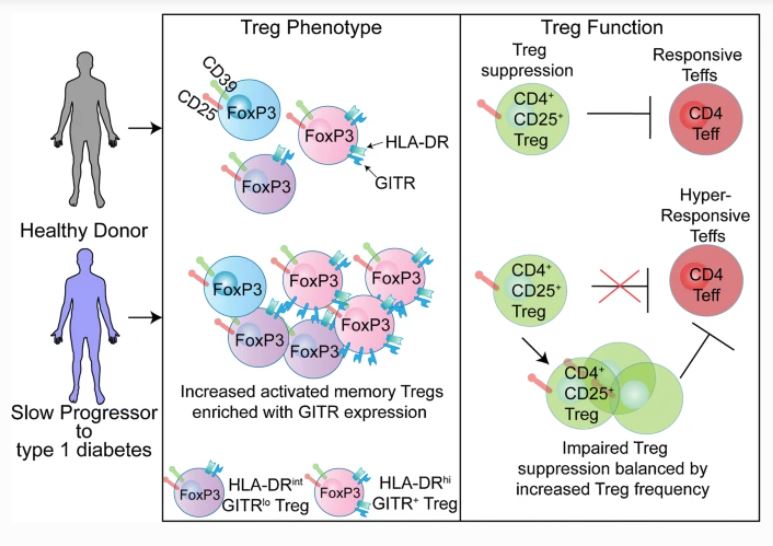 DiabetologiaJnl's tweet photo. Treg profiling in slow progressors to type 1 diabetes @BoldisonJoanne @Wongcardiff, @KGillespieBris, @AnnaLongBris, @BOXfamilystudy #type1diabetes https://t.co/yaAqaWjabP 🔓 https://t.co/oZbF4B45GW
