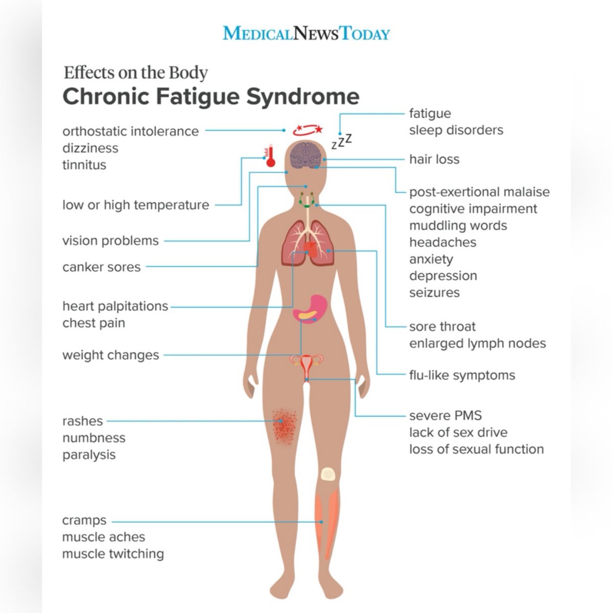 13MeganMarie's tweet photo. This is now robbing me of my energy&amp;physical ability to socialise, play football etc. So please be mindful of others lives because you might not realise what they are going through. It's now time to work out what the heck is going on and manage my symptoms.

Part 4 #MECFS https://t.co/D3As0fMdD2