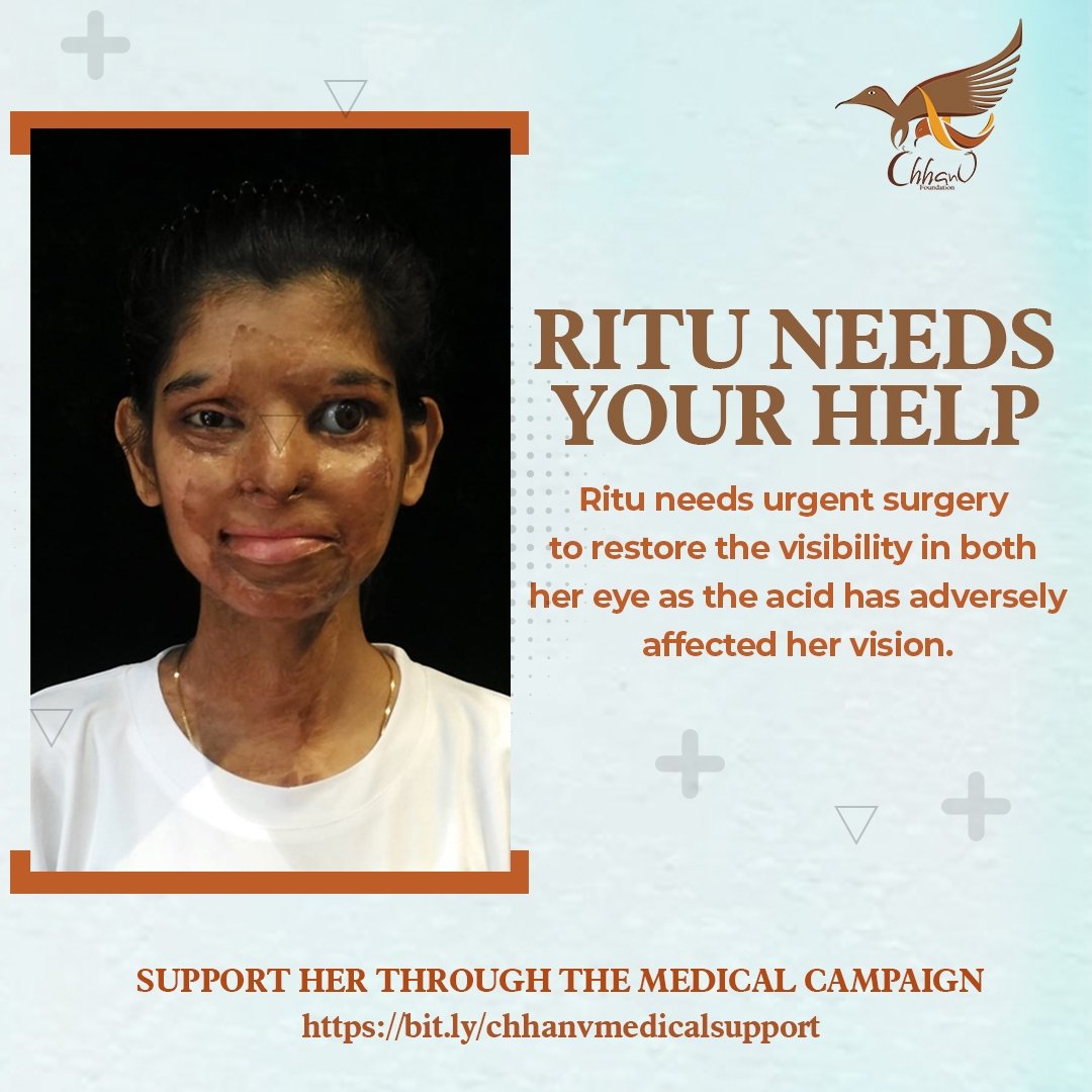 StopAcidAttacks's tweet photo. Ritu’s life  changed after the acid attack as she gets irreversible disfigurement and intolerable agony. She is in critical need of eye treatment surgery. 
https://t.co/rIe6ce6ozQ https://t.co/0S5Q77xXoH