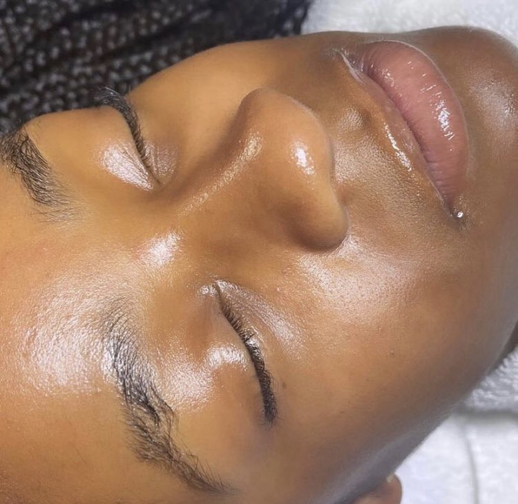 RefineClinicUG's tweet photo. It’s #PeelSaturday tomorrow🤲🏽🤲🏽
🦋 Consultation + Chemical Peel - UGX 80,000
🦋 Consultation + Chemical Peel + Sunscreen - UGX 150,000
📞 0758 232 889.
Don’t miss🤗🤗
#BeFlawless #ChemicalPeel #ChemicalPeelSaturday #Sunscreen #SkinGoals #Refine #GetRefined https://t.co/vIzEAx2JZe