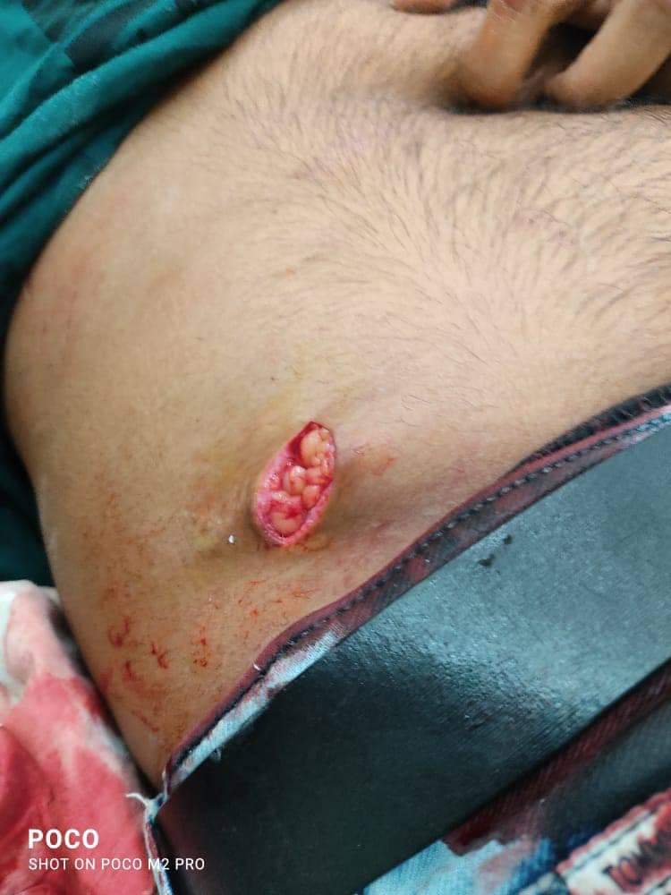 TajinderBagga's tweet photo. कैलाश्रर,त्रिपुरा में इस्लामिक आतंकवादियों ने एबीवीपी कार्यकर्ता के पेट में चाकू मारा और काली मंदिर में तोड़फोड़ की । https://t.co/wyhPslAt2T