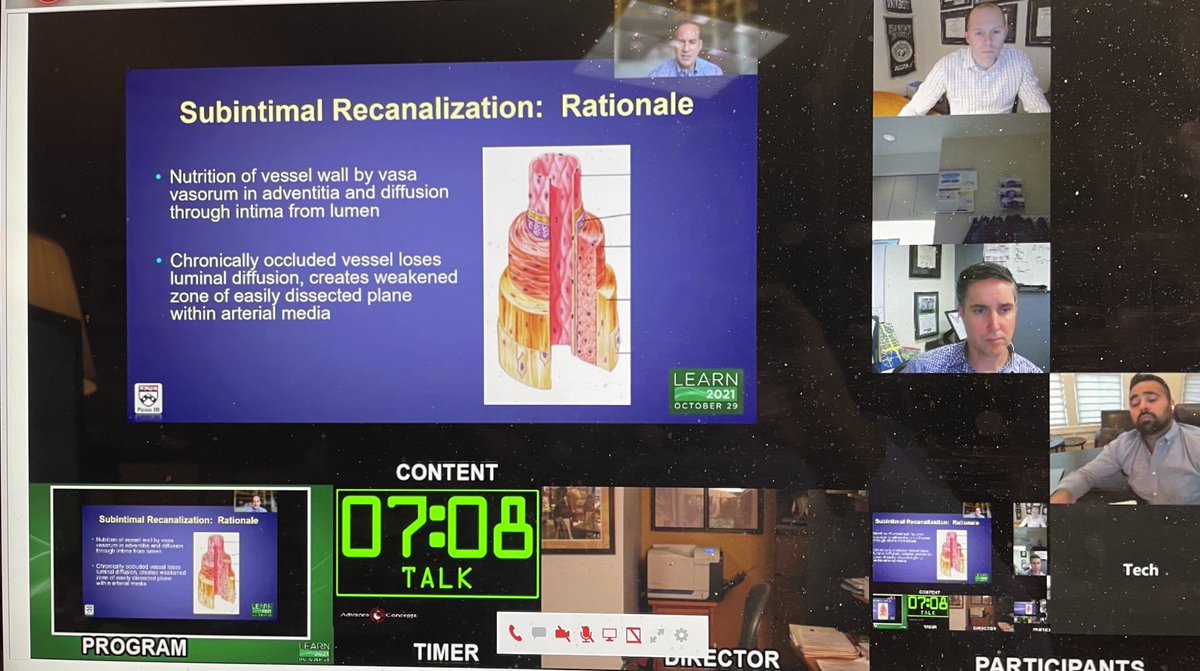 Live #LEARN2021 Tim Clark MD reviews subintimal crossing for fem-pop ⁦<a href="/SIRspecialists/">Society of Interventional Radiology</a>⁩ ⁦<a href="/SIR_ECS/">SIR ECS</a>⁩ ⁦<a href="/SIRRFS/">SIR RFS</a>⁩