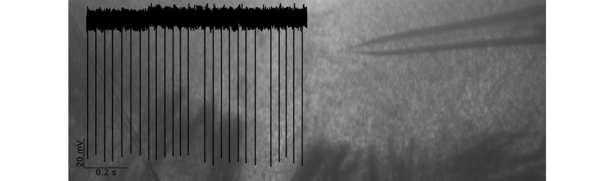 Scientifica_Int's tweet photo. Learn when and why to use cell-attached patch clamp #electrophysiology to monitor neuronal activity, including to measure spontaneous firing, membrane potential & synaptic inputs. #patchclamping #science #AppNote #neuroscience
https://t.co/6u2YTJo6c7 https://t.co/hM0Ieg8LOR