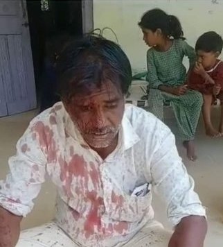 BairwaDeepak93's tweet photo. गुजरात में मंदिर जाने पर दलित परिवार पर जानलेवा हमला। शर्मनाक। #DalitLivesMatter https://t.co/BuQ9RFRTVs