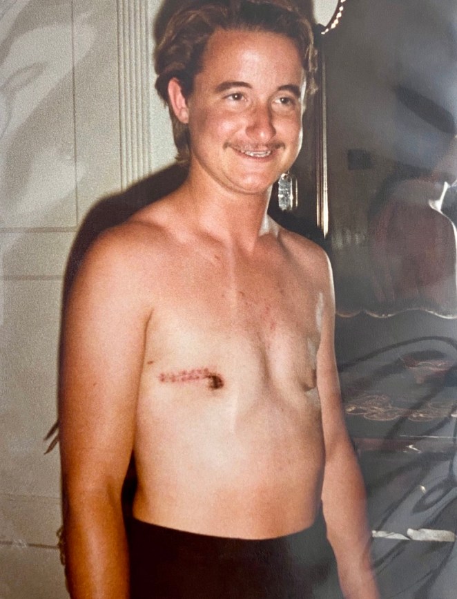 @roomofonesownbooks.bsky.social (@roomofonesown) on Twitter photo I've never seen this photo of Lou Sullivan post-top surgery in the 1980s. <3
“I want to learn to love my body + feel all its sensations.” — Lou Sullivan I've never seen this photo of Lou Sullivan post-top surgery in the 1980s. <3
“I want to learn to love my body + feel all its sensations.” — Lou Sullivan