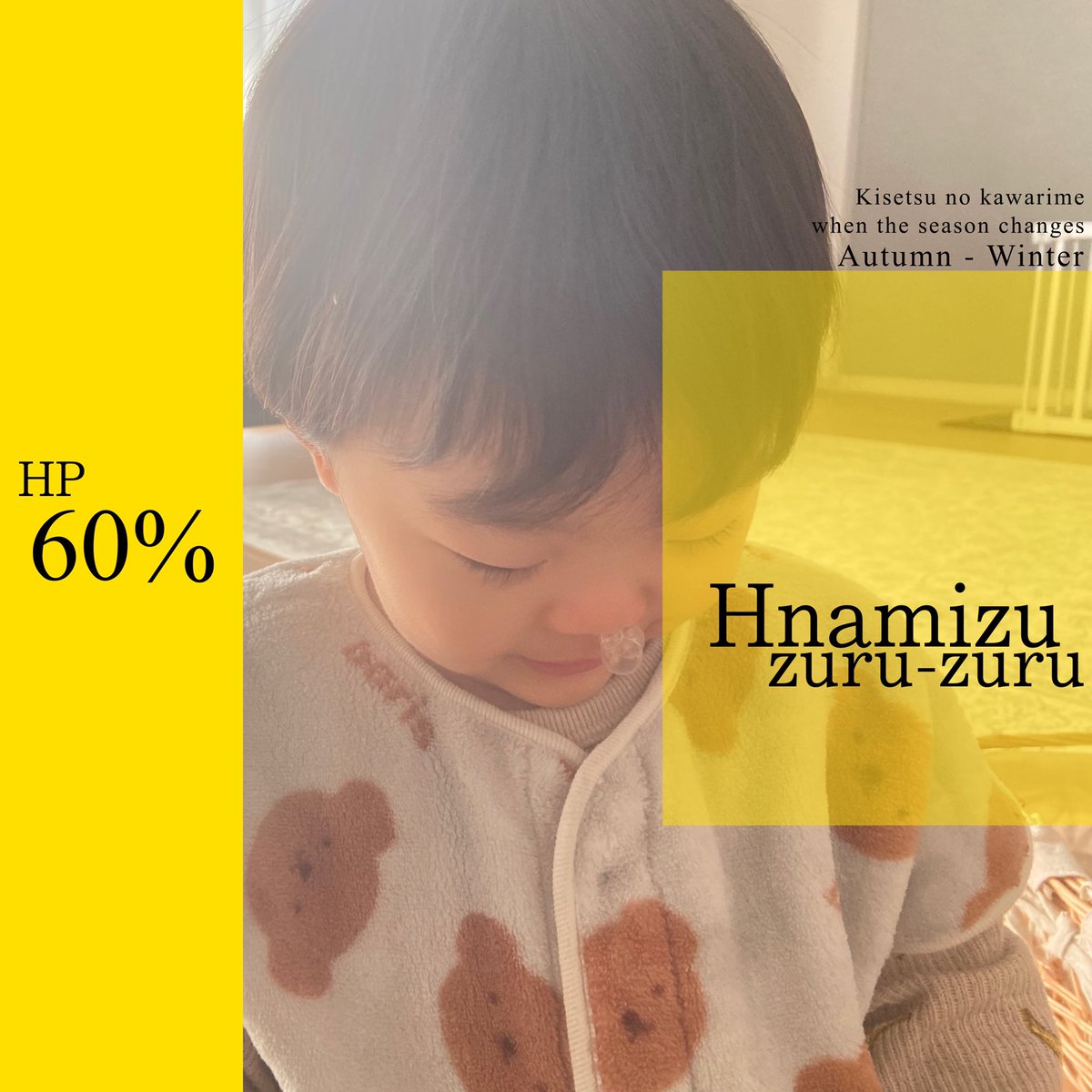 鼻水ずるずる、鼻ちょーちん。