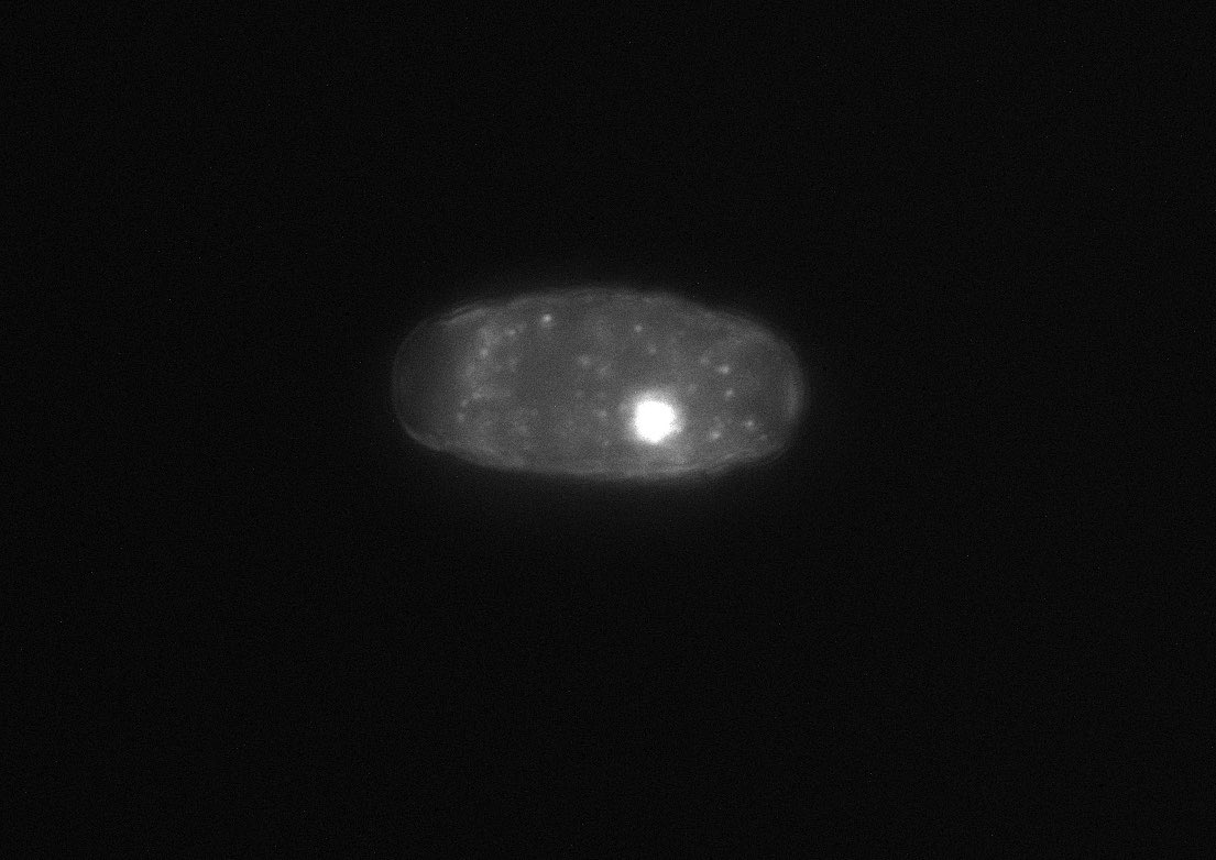 DAPI stain of powdery mildew conidium. Big bright spot is the nucleus and the tiny speckles mitochondrial DNA? Maybe just poor staining technique. Thoughts?