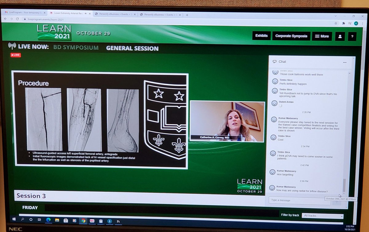 Mani NBS (@maninbsir) on Twitter photo Proud to see one of our Resident Catherine Carney presenting a case of DAV in LEARN2021 under the guidance of <a href="/CarlosGuevaraIR/">Carlos Guevara MD, FSIR</a> <a href="/WashUIR/">Mallinckrodt IR</a> <a href="/Sushinsk/">Sasha Ushinsky</a> <a href="/kmadass/">Kumar Madassery</a> <a href="/keithppereira/">Keith Pereira MD, #VIrad</a> <a href="/LessneVIR/">Mark Lessne, MD</a> Proud to see one of our Resident Catherine Carney presenting a case of DAV in LEARN2021 under the guidance of <a href="/CarlosGuevaraIR/">Carlos Guevara MD, FSIR</a> <a href="/WashUIR/">Mallinckrodt IR</a> <a href="/Sushinsk/">Sasha Ushinsky</a> <a href="/kmadass/">Kumar Madassery</a> <a href="/keithppereira/">Keith Pereira MD, #VIrad</a> <a href="/LessneVIR/">Mark Lessne, MD</a>