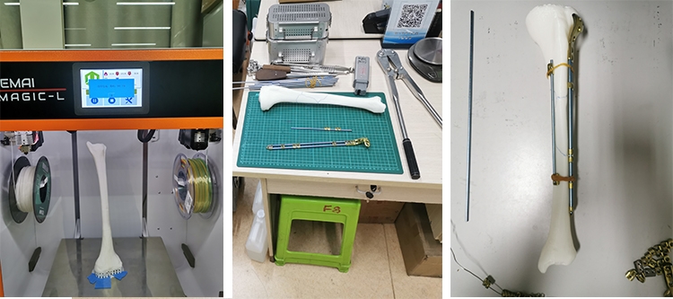 Iemai3's tweet photo. Preoperative simulation, instrument matching
#printing #3dprinting #Manufacturing #Industrial #Medical #Prothesis #Impant https://t.co/FgZaD7ZWuh