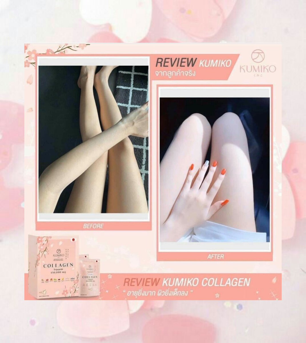 iradcha's tweet image. ใครกำลังตามหาคอลลาเจน
อยากลองต้องรีบตำ
ลดพิเศษ 2 วันเท่านั้น!!!!
👉 คูมิโกะคอลลาเจน เป็นคอลลาเจนไตรเปปไทน์
👉ดูดซึมง่าย ละลายไว ไม่คาว
#คอลลาเจน #ขายของออนไลน์ #รีวิวยยยยย #ของดีบอกต่อ #ผิวขาว #รีวิวขาย #ผิวตัวใสเหมือนหน้า #ผิว #คูมิโกะ