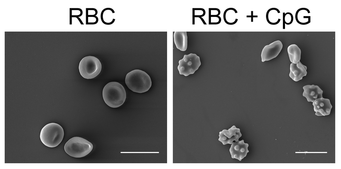 ScienceMagazine's tweet photo. New research from @ScienceTM reveals that #RedBloodCells help activate the innate immune response to #sepsis and viral pneumonia in patients—a finding that contradicts the established view of these cells as immunologically inert. https://t.co/JZu9LuCPJ1 https://t.co/Uld2pMGBIG