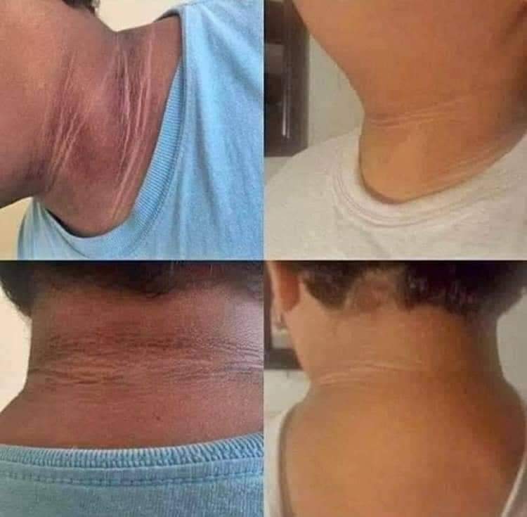 Lush_Beauty1's tweet photo. Are you struggling with dark marks ,Acne or Oily Skin?

This polishing Bar helps with it all!!! 

🌿 Lightens and smoothy skin.
🔹Helps with acne.
🔹removes oil build up and dead skin cells! 

For men and women
Whatsapp 0749777590
#DJSBU https://t.co/jn7ITTWRKs