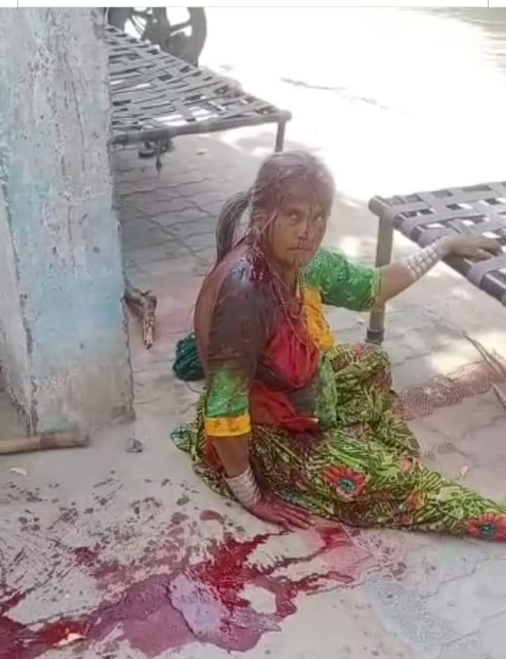 jigneshmevani80's tweet photo. TW: Disturbing images. 
A family was brutally attacked by people of  in Kutch district of Gujarat for entering a temple. @RDAMIndia team has been assisting the family and an FIR has been registered. BJP-led Gujarat government is a mute spectator as always. https://t.co/eh42oV4NgQ