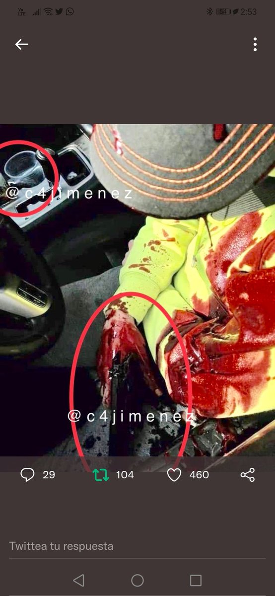 jesusnicolas's tweet photo. Esto no se puede negar, por justicia para Octavio Ocaña se debe investigar y castigar a los policías. 

No tenía arma, la posición de la mano era otra en las primeras fotos, estaba hacia su rostro.

Perdón por difundir la imagen, pero es necesario demostrar la verdad. https://t.co/c6S8TbXkLR