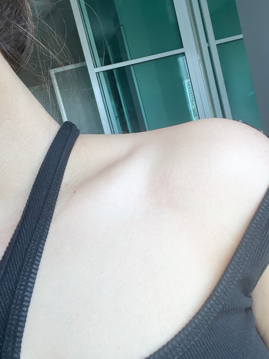 Tippiieeee's tweet image. ⛅️🎨 𝐌𝐨𝐧𝐝𝐚𝐲 𝐒𝐮𝐧𝐝𝐚𝐲 𝐁𝐨𝐝𝐲 𝐆𝐥𝐨𝐰𝐢𝐧𝐠 𝐋𝐨𝐭𝐢𝐨𝐧 ชอบใส่เสื้อผ้าอวดผิวต้องมีตัวช่วยบำรุงผิวสักหน่อย ขอป้ายยาแบรนด์นี้เลยบำรุงให้ผิวดูโกลว์แบบฉ่ำ นุ่มชุ่มชื่นดูสุภาพผิวดีใครมีริ้วรอยขอให้ขยันโบกพวกรอยดำจางลงเเน่นอน เนื้อครีมไม่เหนอะหนะอีกด้วย 🎨⛅️ #mondaysunday