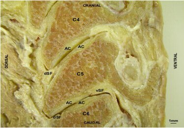 Retlouping's tweet image. The difference in Cervical and Lumbar foramen and nerve root positions. 

Note cervical roots sit in the superior notch (inferior foramen) , whilst lumbar sit int he inferior notch (superior foramen)