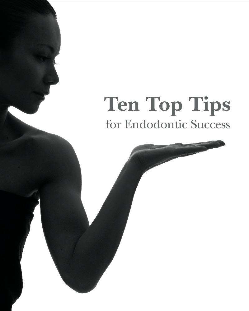 Ten Top Tips for Endodontic Success - BOOK NOW - mailchi.mp/sendoline/d62k…