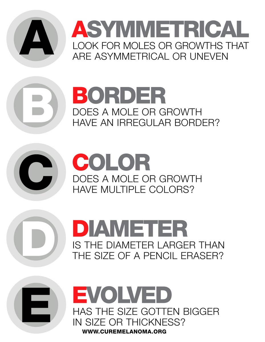 MelanomaReAlli's tweet photo. Melanomas can vary greatly in how they look. Often the first sign of melanoma is a change in the shape, color, size, or feel of an existing mole. However, melanoma may also appear as a new mole or a rapidly enlarging bump. https://t.co/Pa4GVSP4i4