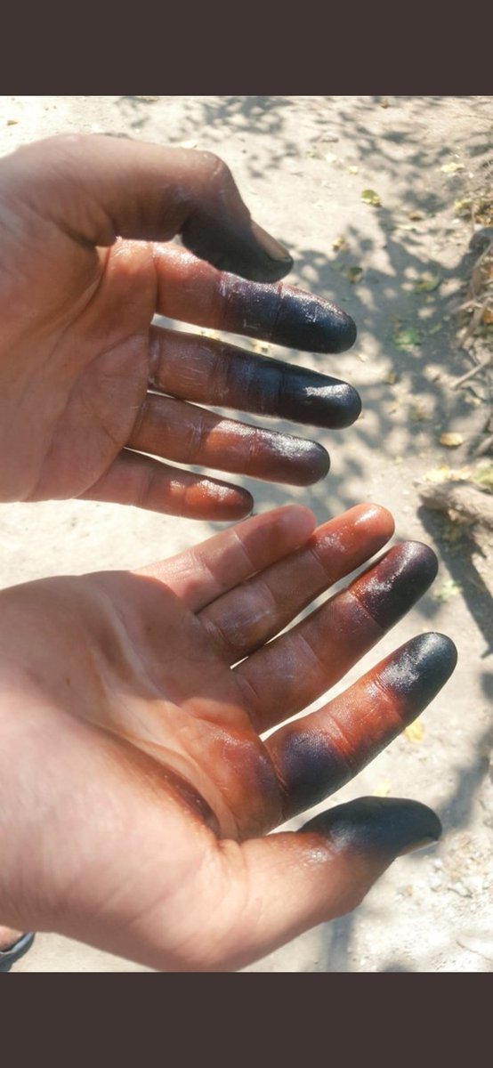 Bu ellerin sahibi 4 sene ilkokul 4 sene ortaokul 4 sene lise ve en az yıl 2 önlisans düzeyinde eğitim görmüş. Sayısını kendisinin dahi bilmediği sınava girmiş dirsek çürütmüş birisinin eli. Bu eller bu şekilde heba edilmemeli. <a href="/drfahrettinkoca/">Dr. Fahrettin Koca</a>
#HayatVerenEllereAtamaSart