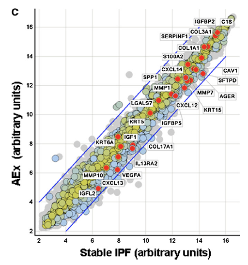 KaminskiMed's tweet photo. @leticiakawano @virenkaul @aasimhasany @KerriBerriKerri @AneesaDas @subanichandra @GallodeMoraesMD @gretchemaben @accpchest I'm not aware of studies comparing tissue histology in early vs late #AEIPF. In our molecular profiling study (old, but still the ONLY one methinks) we saw cell death and DAD, but no evidence for the type of inflammation one would treat with steroids https://t.co/f0BSe8Pclf https://t.co/v9vX1rEJhf