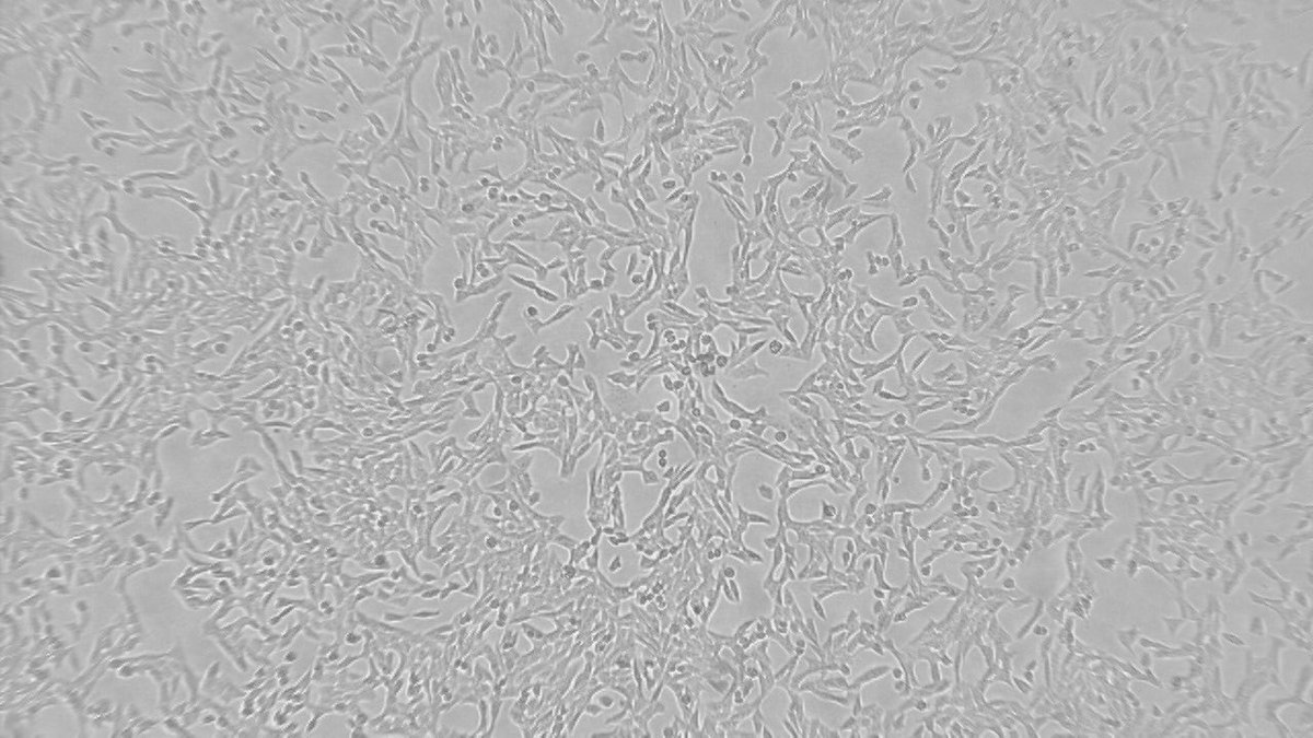 #CancerResearch Together with her colleague, Postdoctoral Fellow (Radiation Biophysics – specialization in Radiochemistry) Dr Shankari Nair, using these cervical cancer cells, they’re also evaluating a new patented radiopharmaceutical they’ve synthesized. KB Image : Supplied