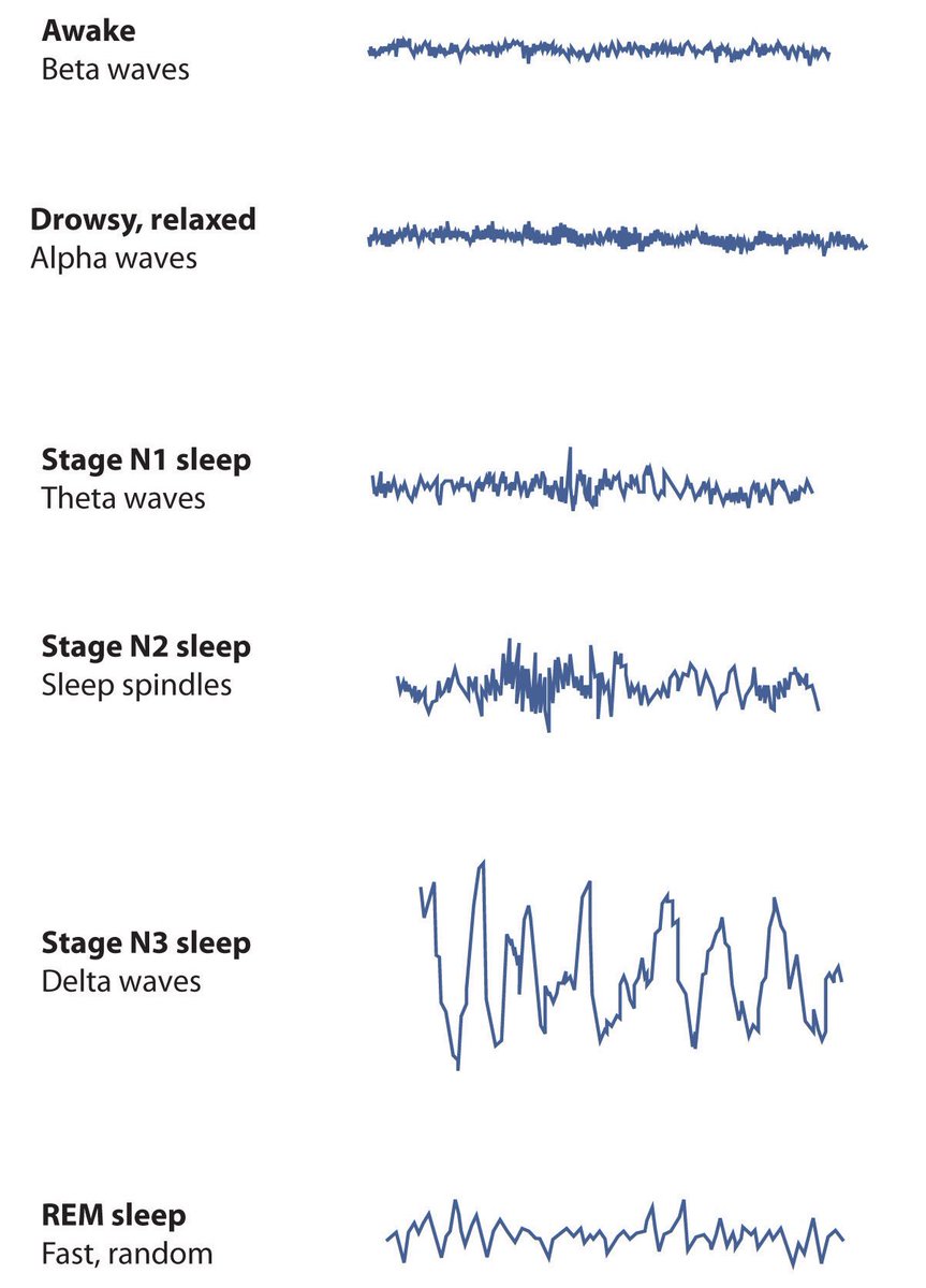 These are EEG recordings of brain patterns during a night of sleep. Each stage of sleep has its own distinct pattern of brain activity.