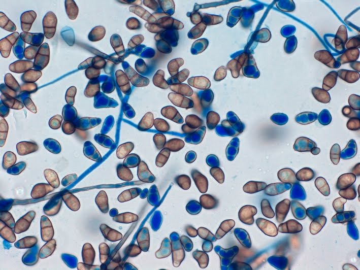TheLabDoc's tweet photo. "Croissant" conidia of Curvularia spp. #PathTwitter #MicroRounds #IDTwitter #MicroMed #MedStudentTwitter @Starbucks https://t.co/kyJ2HRqx4O