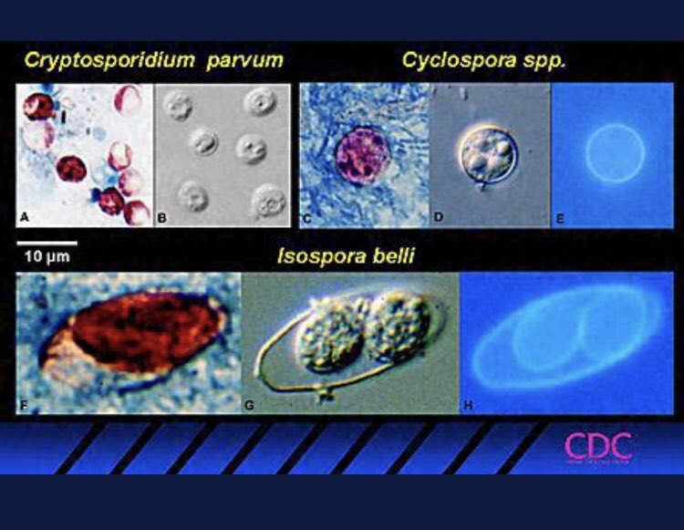 IUIDfellowship's tweet photo. #cryptosporidium https://t.co/mQGiK5nsRc