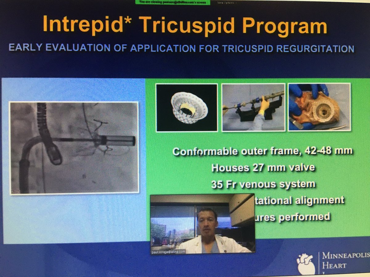 UIowaIC's tweet photo. A fantastic cardiology grand rounds today by Dr. Paul Sorajja @MHIF_Heart!! https://t.co/bJGbk0fQ4e