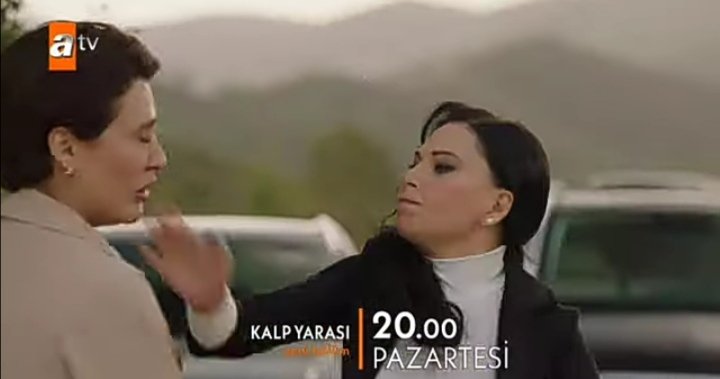 Hande: ben sadece feriti istiy...
Ayfer fanları👋 😂🤣
#KalpYarasi
#Ayfer