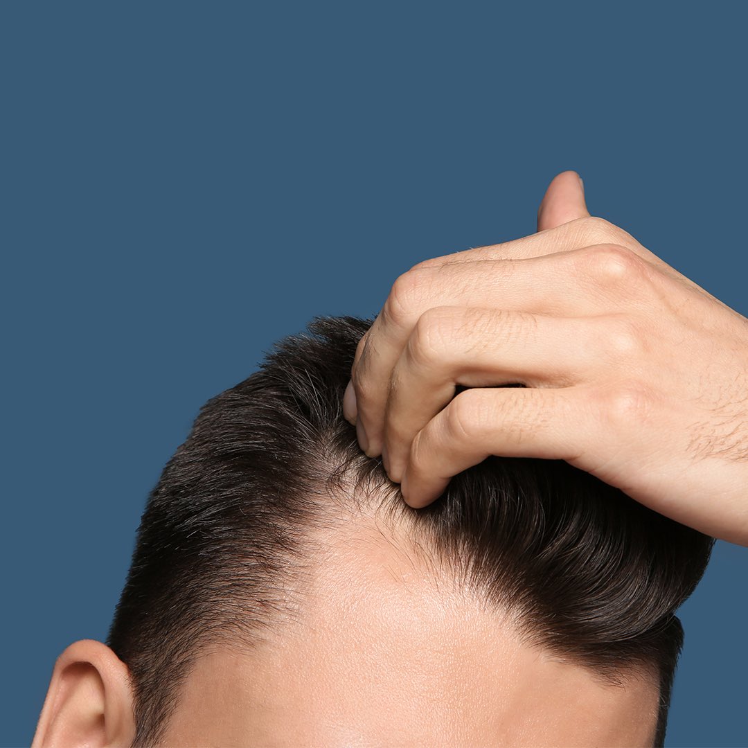 News Release |  LOW-LEVEL LASER TREATMENT CAN STIMULATE HAIR FOLLICLES AND HAIR GROWTH, EXPERT FINDS
 bit.ly/3n4ycet

#hair #hairgrowth #hairfollicles #baldness #hairloss #laser #lowlevellaser #treatment medicalstudy #chulalongkornuniversity
#primejournal #aesthetic