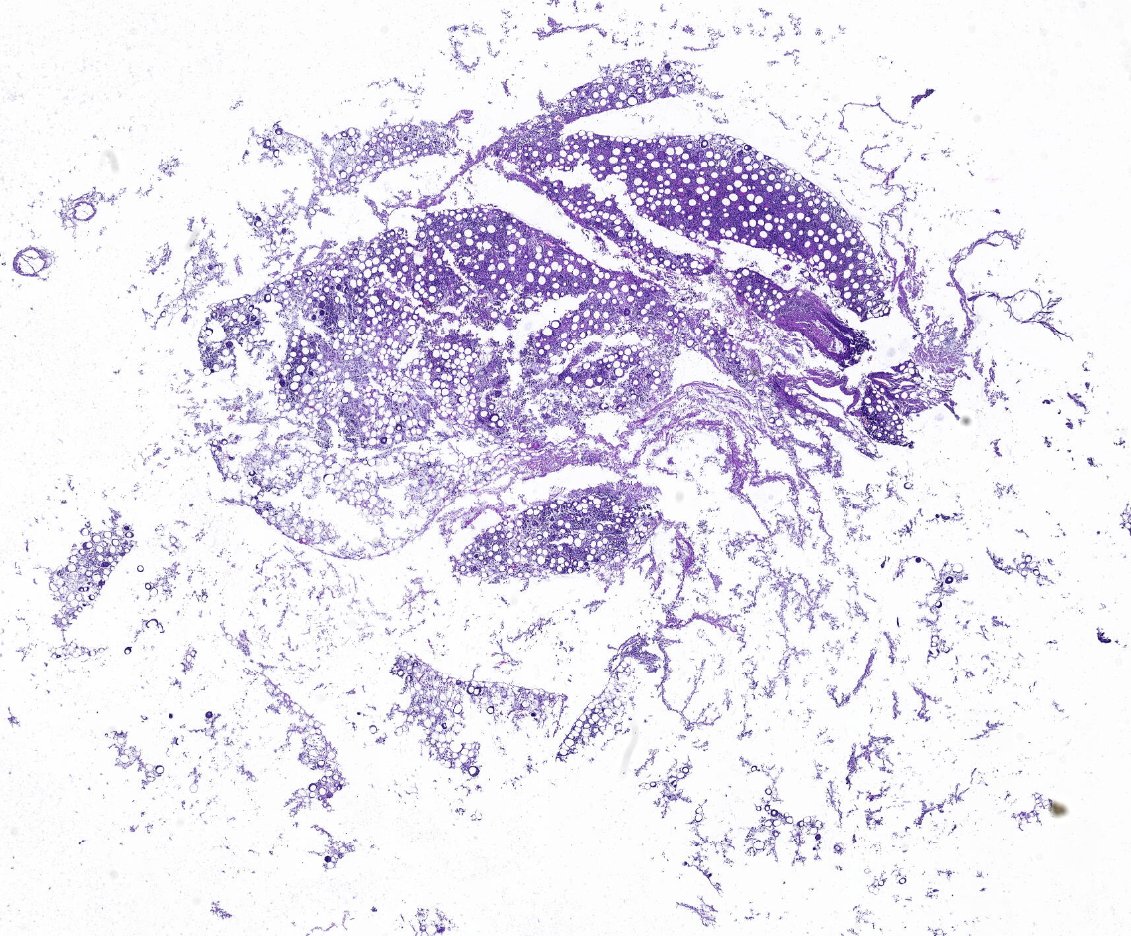 KFBIO1's tweet photo. 3. A broadband network, specially installed for telepathology
4. Hardware infrastructure, such as a digital pathology scanner
#telepathology
#pathologycloud
#pathologyimage
#slidesharing https://t.co/X6PArtvKvP