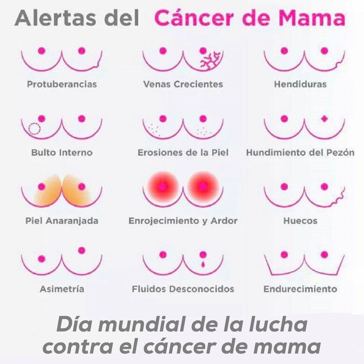 El cáncer de mama es el más frecuente entre las mujeres en España (en 2020, 34mil nuevos casos). Pero es también uno de los más investigados y de los que más supervivencia tiene.⁣
⁣
Apostemos por la investigación y el diagnóstico temprano.
#DiaMundialdelCancerdeMama #SacaPecho