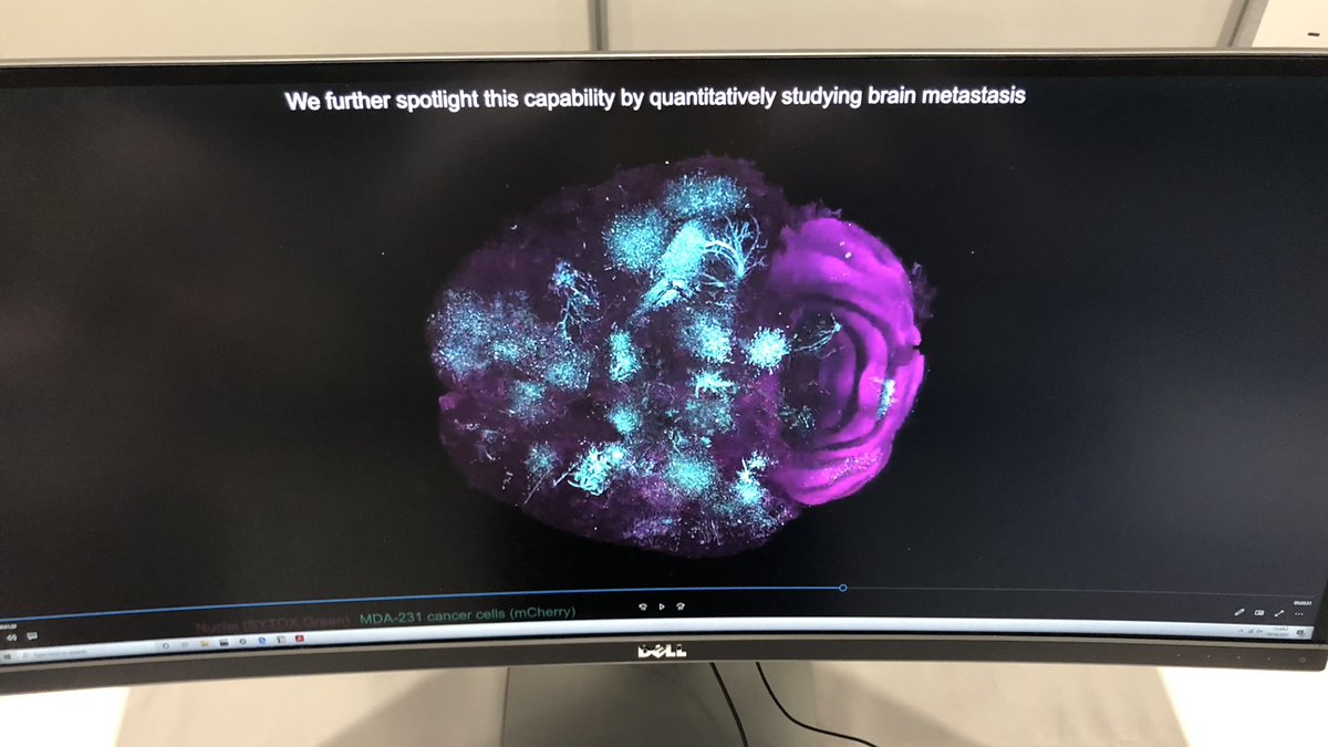 Cairn_GRog's tweet photo. With @lightspeedmicro at @ELRIG for #DrugDiscovery21 to talk about the hybrid open-top light sheet. Always nice to see some of the great data sets captured by @adam_k_glaser using this system https://t.co/i5XYjowC0F