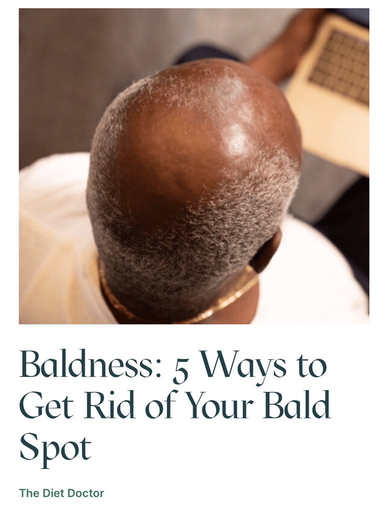 Diet_234's tweet photo. If you’re experiencing baldness you will understand why the hair is regarded as the “crowning glory”. It significantly affects a person’s appearance and demeanour. This is why baldness or a bald spot can considerably affect one’s confidence. 

Learn more - https://t.co/PrPO8jfkOP https://t.co/m2A0YnrlRv