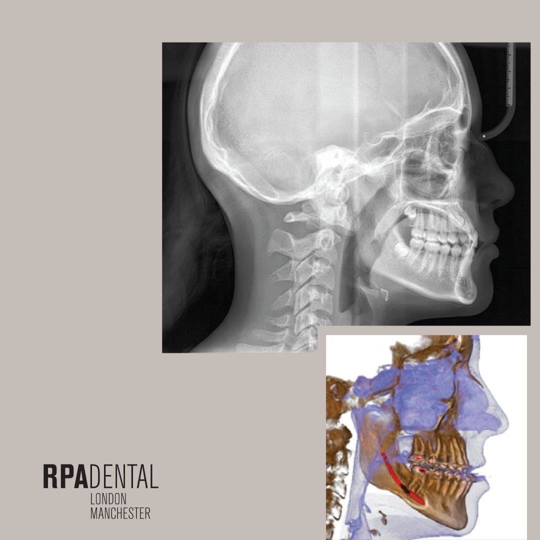 HyperionX9 pro - Future Proof Your Surgery - 2D/3D high-definition imaging and cuttingedge technology for a complete, upgradable, and small-sized platform. Hyperion X9 pro meets every diagnostic requirement by easily integrating into the work flow and guaranteeing maximum comfort