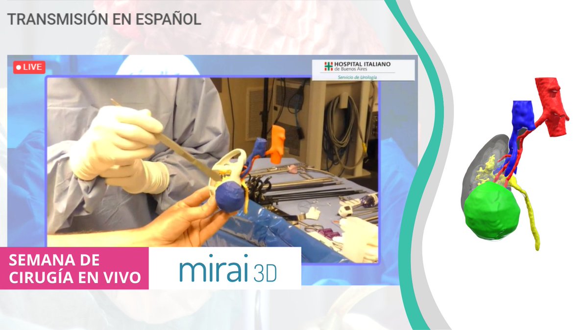 miraisurgical's tweet photo. Semana de cirugía en vivo en @UroHIBA con una demostración magistral del uso de #3D #planning en #LapPartialNephrectomy Gracias a @amjurado67 @DrVitagliano @ClovisFraga @MSGONZALEZURO 👏🏼👏🏼 #UroSoMe https://t.co/SjPxSNhnrP